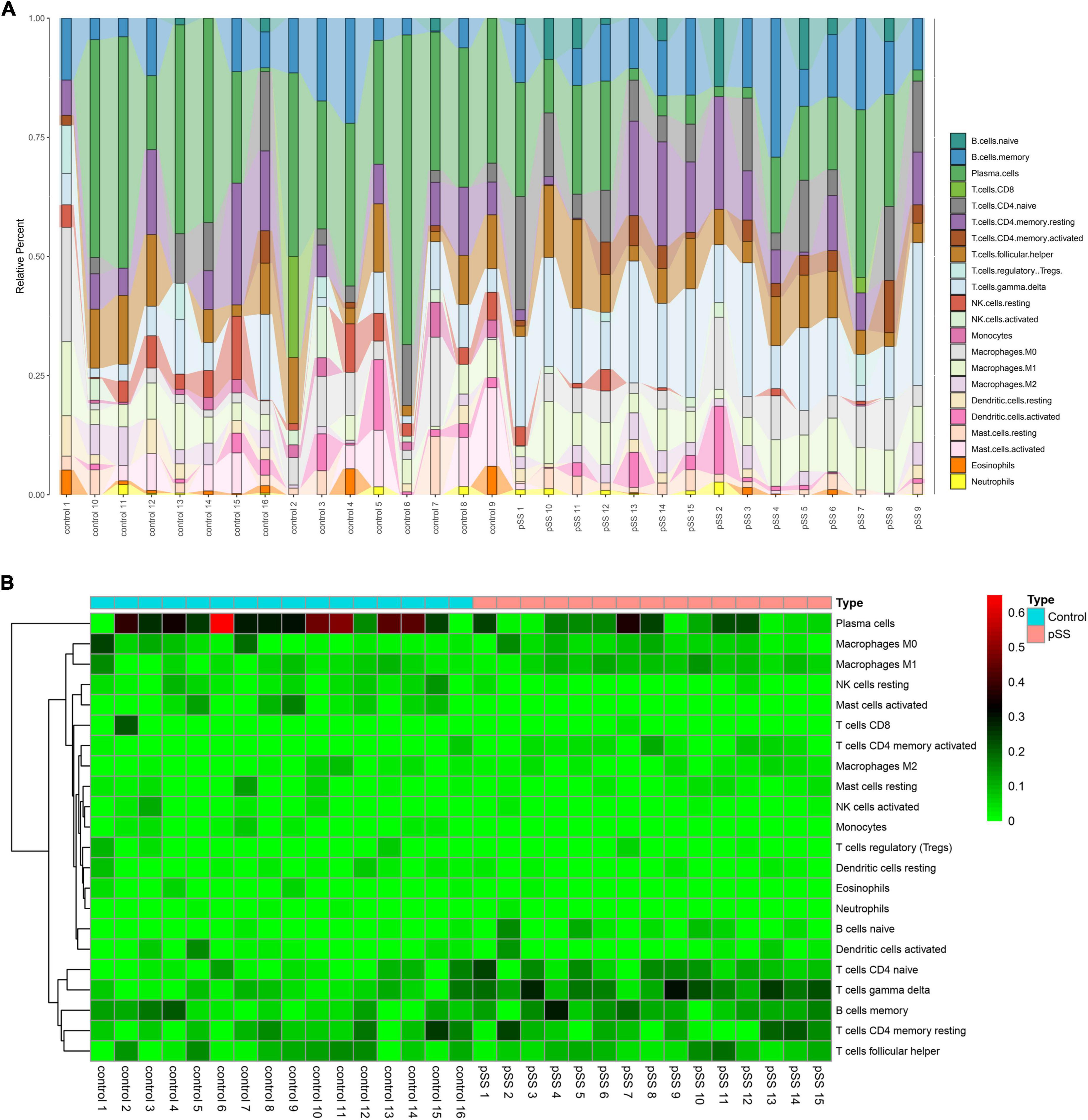 Immune infiltration analysis reveals immune cell signatures in salivary gland tissue of primary Sjögren’s syndrome